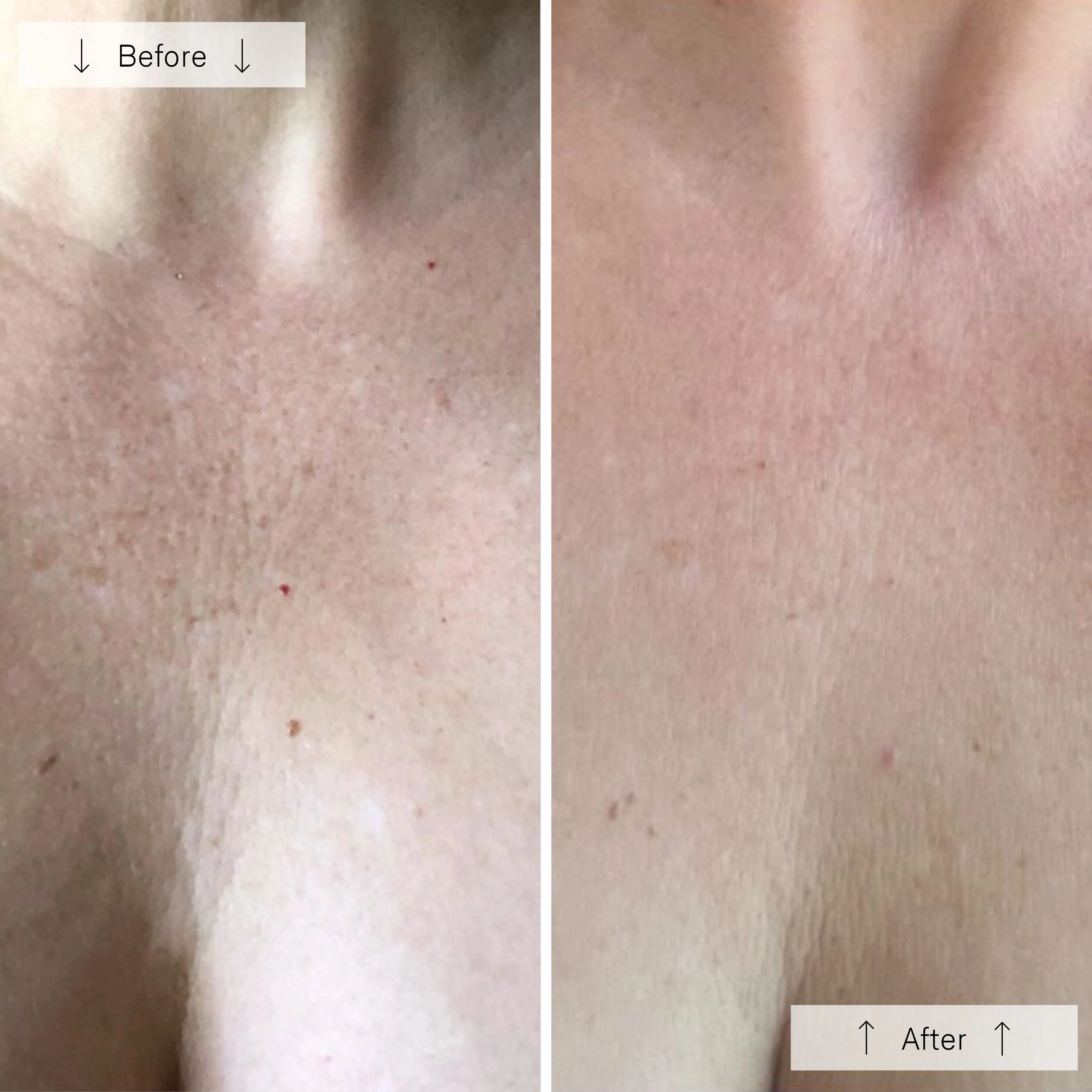 Omnilux Contour Neck & Décolleté - Image 10