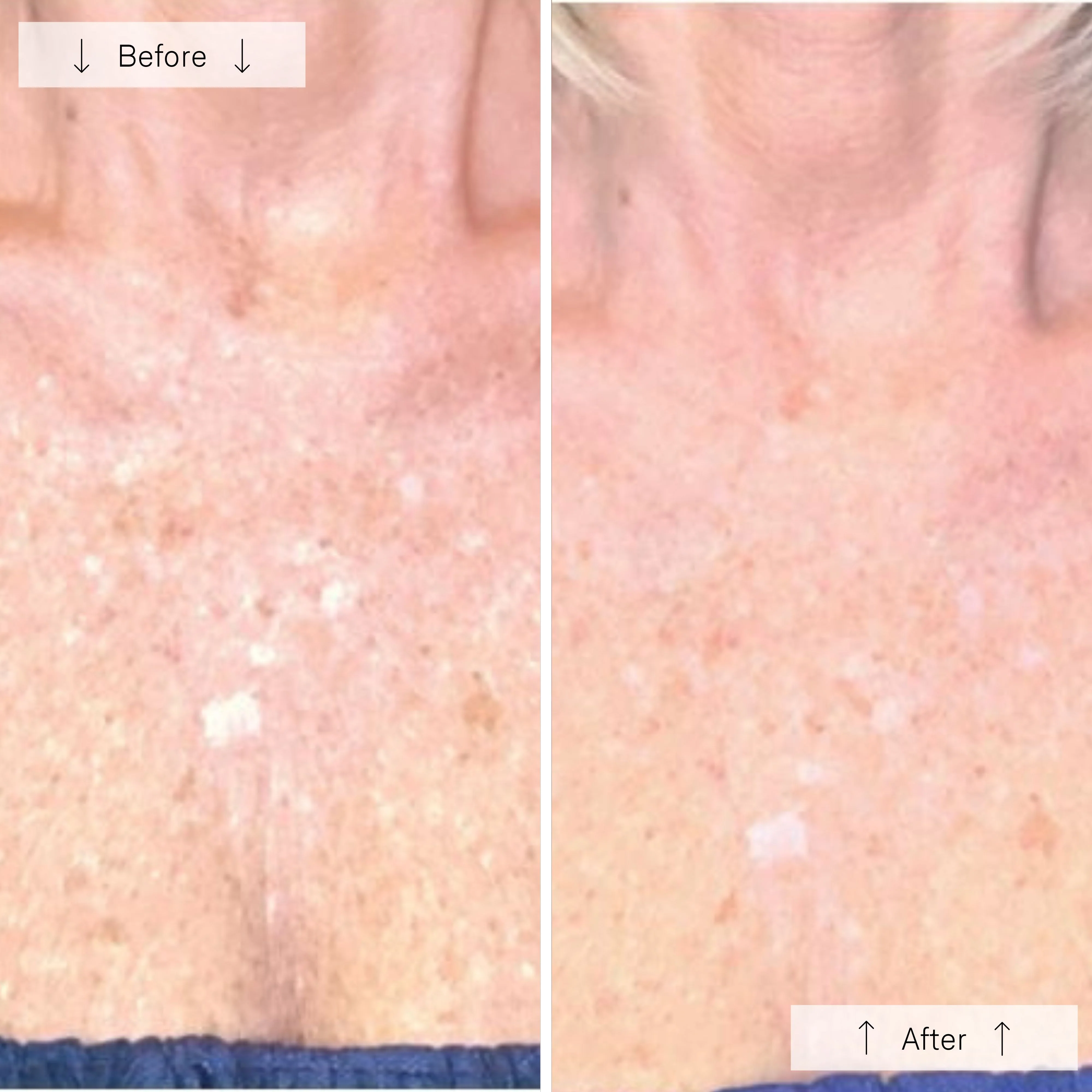 Omnilux Contour Neck & Décolleté - Image 11