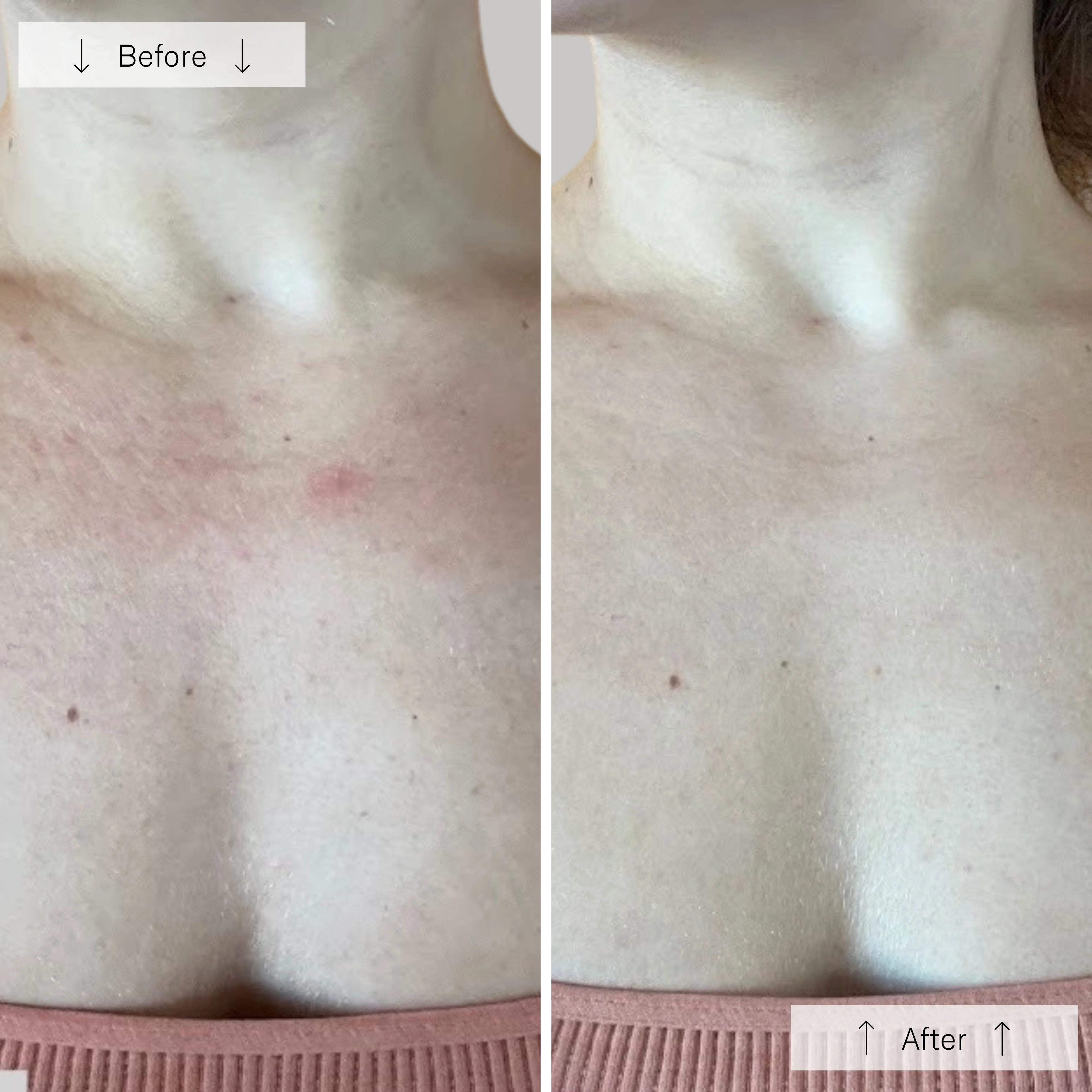 Omnilux Contour Neck & Décolleté - Image 9